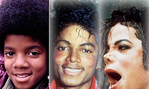 Bí mật về màu da của Michael Jackson - Ngôi sao