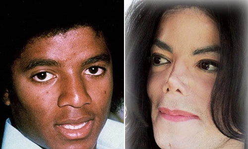 Bí mật về màu da của Michael Jackson - Ngôi sao