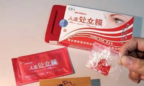 fgf