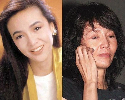 Trịnh Du Linh cố gắng níu kéo tuổi xuân bằng cách đi căng da mặt, nhưng báo chí phát hiện ra da cổ cô nhăn nheo "đúng tuổi". Trịnh Du Linh cố gắng níu kéo tuổi xuân bằng cách đi căng da mặt, nhưng báo chí phát hiện ra da cổ cô nhăn nheo "đúng tuổi".