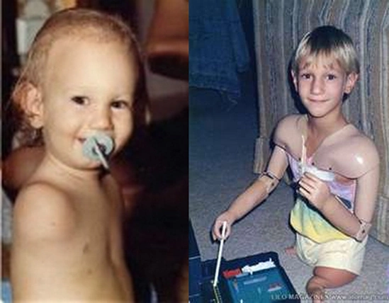 Nick Vujicic sinh ngày 4-12-1982 tại Úc. Từ lúc chào đời anh không có tay lẫn chân. Đến bây giờ vẫn không có nghiên cứu khoa học nào có thể giải thích được điều này. Thế nhưng, bố mẹ anh luôn cố gắng giúp anh có một cuộc sống bình thường như bao đứa trẻ khác. Nick Vujicic sinh ngày 4-12-1982 tại Úc. Từ lúc chào đời anh không có tay lẫn chân. Đến bây giờ vẫn không có nghiên cứu khoa học nào có thể giải thích được điều này. Thế nhưng, bố mẹ anh luôn cố gắng giúp anh có một cuộc sống bình thường như bao đứa trẻ khác.