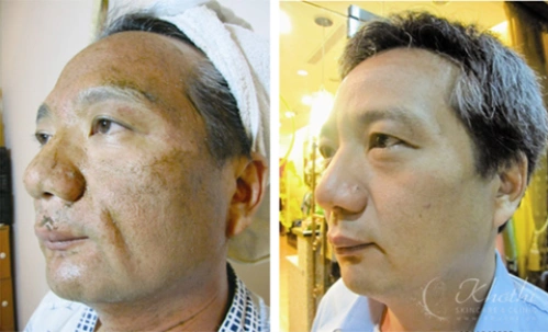 Hình ảnh kết quả điều trị được báo cáo thực nghiệm bằng công nghệ tảo sống. Hình ảnh kết quả điều trị được báo cáo thực nghiệm bằng công nghệ tảo sống.