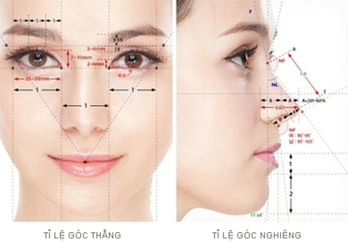 Ti-le-vang-3043-1418271398.jpg