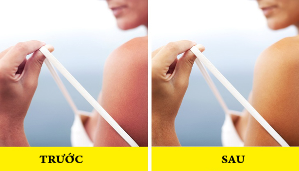 Làm dịu da cháy nắng Trộn 1 thìa nước cốt chanh với nước hoa hồng và nước ép dưa chuột, ngâm một miếng vải vào hỗn hợp rồi đắp lên vùng da bị cháy nắng trong 30 phút. Dưa chuột và chanh là chất tẩy trắng tự nhiên sẽ làm giảm sự đỏ da. Vitamin C trong chanh làm giảm thiểu tổn thương da và làm sáng các đốm đen. Lưu ý, không nên tiếp xúc với ánh nắng mặt trời sau khi sử dụng liệu pháp này.
